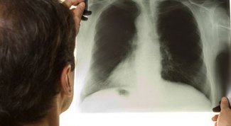 Как не заразиться туберкулезом
