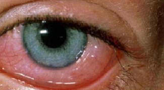 Что такое глазной клещ