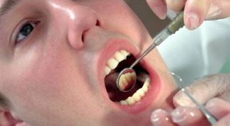 Как узнать, что зуб гнилой