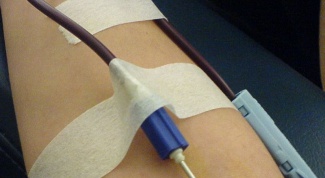 How to check blood for AIDS from donors