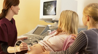 Do I need an ultrasound during pregnancy