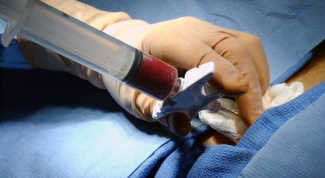 What is a biopsy and a bone marrow puncture