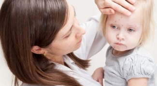 What not to do when chicken pox?