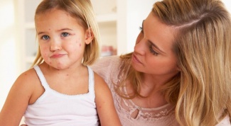 How long is the quarantine after chickenpox 