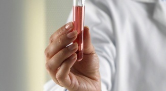 How to test for prothrombin