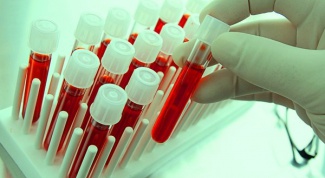 A blood test for cancer: abnormalities