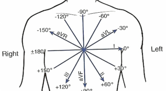 Что такое электрическая ось сердца
