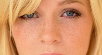 Веснушки на лице: косметологические процедуры
