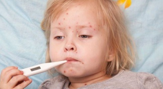 How contagious chicken pox