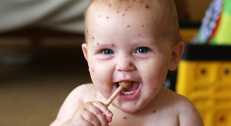 Dangerous chicken pox for an infant?