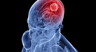 Causes of brain cancer