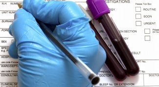 Расшифровка анализа крови на онкомаркеры