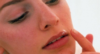 Лечение простуды на губе