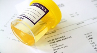 How to pass a urine analysis on Nechiporenko