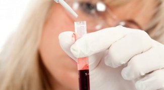 Какой анализ выявляет группу крови