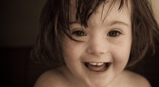 Is down syndrome a hereditary disease