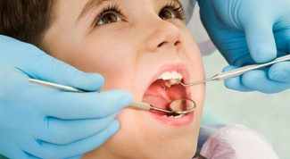 How to treat caries in children