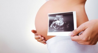 Как уменьшить тошноту при беременности