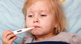 What's the difference between chicken pox measles