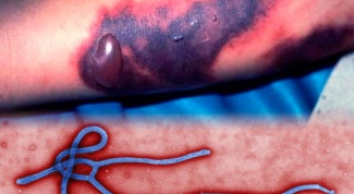 Ebola: the virus description, symptoms, treatment and prevention
