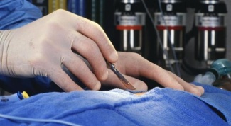 Зачем хирурги тщательно моют руки, если оперируют в перчатках 
