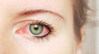 Как лечить воспаленные глаза