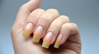 Желтые ногти как признак серьезных нарушений в организме 
