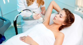 Laser hair removal