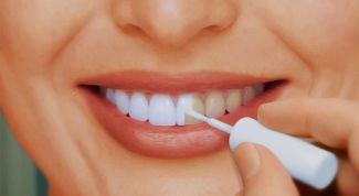 Как использовать перекись водорода для отбеливания зубов