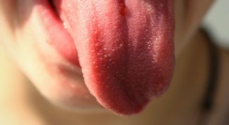 Как выявить болезнь по языку