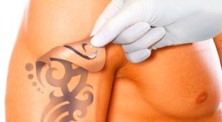 Как свести татуировку: способы удаления тату