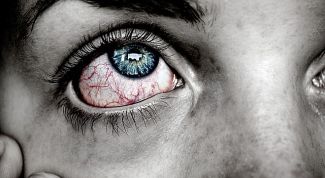 Как бороться с конъюнктивитом и воспалением глаз