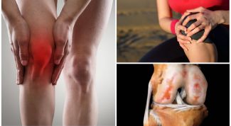 Как вылечить артроз коленного сустава 1 степени