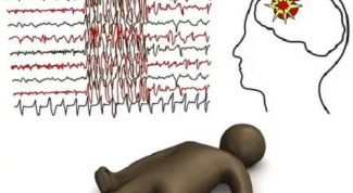 Абсансная эпилепсия: симптомы и лечение
