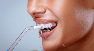 7 незаменимых средств для гигиены полости рта