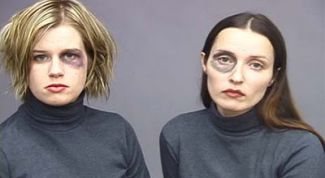 Картинка по теме - как замазать синяк