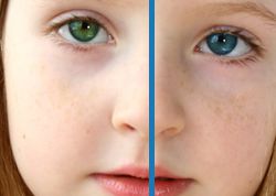 Картинка по теме - как менять цвет глаз в фотошопе