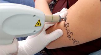 Картинка по теме - как свести тату