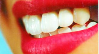 Картинка по теме - как очистить зубы от налета