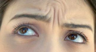 Картинка по теме - как избавиться от мимических морщин