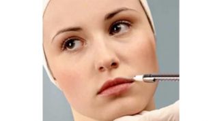 Картинка по теме - как убрать носогубные складки