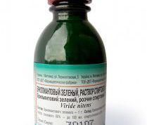 Картинка по теме - как вывести пятна зеленки