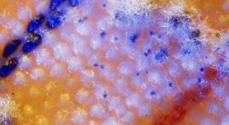 Картинка по теме - как вывести плесень на одежде