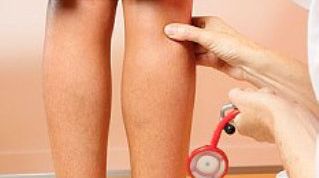 Картинка по теме - как убрать звёздочки на ногах