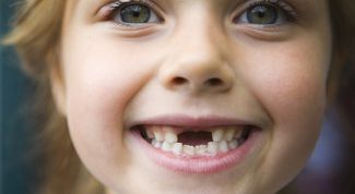 Картинка по теме - как выдернуть зуб дома