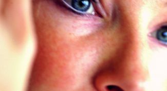 Картинка по теме - как убрать пятна от прыщей на лице