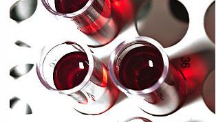 Картинка по теме - как понизить билирубин крови