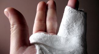 Картинка по теме - как лечить перелом кости