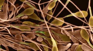 Картинка по теме - как повысить подвижность сперматозоидов