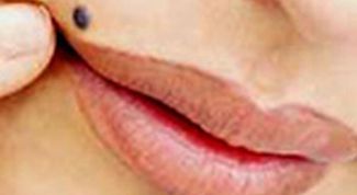 Картинка по теме - как избавиться от родинок